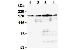 Western Blotting (WB) image for anti-Topoisomerase (DNA) II alpha 170kDa (TOP2A) (N-Term) antibody (ABIN1109282)