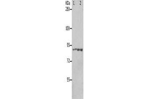 Gel: 8 % SDS-PAGE, Lysate: 40 μg, Lane 1-2: 293T cells, mouse brain tissue, Primary antibody: ABIN7191168(KCNC3 Antibody) at dilution 1/300, Secondary antibody: Goat anti rabbit IgG at 1/8000 dilution, Exposure time: 1 minute (KCNC3 Antikörper)
