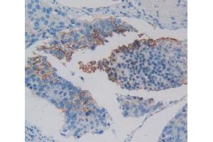 Used in DAB staining on fromalin fixed paraffin- embedded Kidney tissue (XCR1 Antikörper  (AA 244-322))