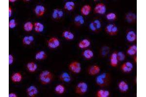 Immunofluorescence (IF) image for anti-Integrin alpha-L (ITGAL) antibody (Alexa Fluor 594) (ABIN2656812) (ITGAL Antikörper  (Alexa Fluor 594))