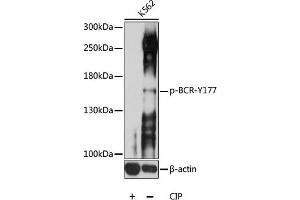 Western blot analysis of extracts of K562 cells, using Phospho-BCR-Y177 antibody (ABIN6135190, ABIN6136026, ABIN6136027 and ABIN6225622) at 1:1000 dilution. (BCR Antikörper  (pTyr177))
