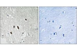 Immunohistochemistry analysis of paraffin-embedded human brain tissue, using RIPK2 (Ab-176) Antibody. (RIPK2 Antikörper  (AA 146-195))