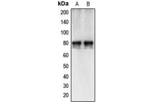 Western blot analysis of Calpain 12 expression in HepG2 (A), A549 (B) whole cell lysates.