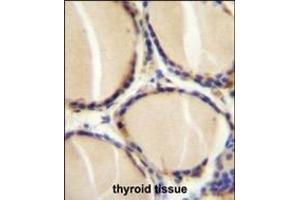 CALCA Antibody (Center) (ABIN655071 and ABIN2844701) immunohistochemistry analysis in formalin fixed and paraffin embedded human thyroid tissue followed by peroxidase conjugation of the secondary antibody and DAB staining. (CGRP Antikörper  (AA 56-83))