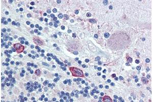 Anti-ERp72 antibody IHC staining of human brain, cerebellum. (PDIA4 Antikörper  (AA 623-638))