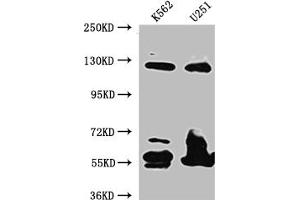 Western Blot Positive WB detected in: K562 whole cell lysate, U-251 whole cell lysate All lanes: BubR1 antibody at 1:1000 Secondary Goat polyclonal to rabbit IgG at 1/50000 dilution Predicted band size: 120, 106, 122 kDa Observed band size: 125 kDa (Rekombinanter BUB1B Antikörper)