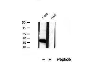 Western blot analysis of extracts of HepG2 cells, using CHCHD2 antibody. (CHCHD2 Antikörper  (Internal Region))