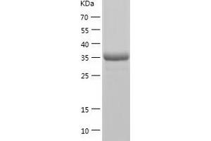 Western Blotting (WB) image for Hexamethylene Bis-Acetamide Inducible 1 (HEXIM1) (AA 1-359) protein (His tag) (ABIN7123324) (HEXIM1 Protein (AA 1-359) (His tag))