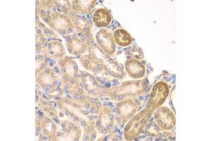 Immunohistochemistry of paraffin-embedded rat kidney using PIP4K2A antibody (ABIN6130624, ABIN6145673, ABIN6145674 and ABIN6223324) at dilution of 1:100 (40x lens).