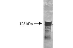 Both the antiserum and IgG fractions of anti-Glycerol Kinase (Cellulomonas) are shown to detect the 128,000 dalton enzyme in cellular extracts. (Glycerol Kinase Antikörper)