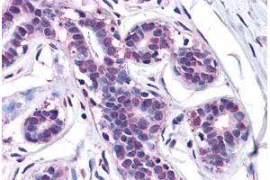 Human Breast: Formalin-Fixed, Paraffin-Embedded (FFPE) (MFI2 Antikörper  (N-Term))