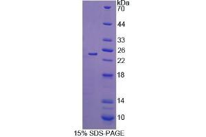 SDS-PAGE analysis of Mouse SHBG Protein. (SHBG Protein)