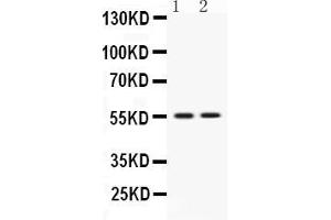 Western blot analysis of VRK1 expression in rat thymus extract ( Lane 1) and JURKAT whole cell lysates ( Lane 2).