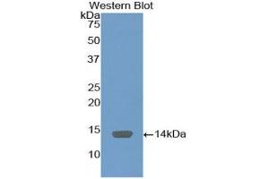 Detection of Recombinant C4BPa, Mouse using Polyclonal Antibody to C4 Binding Protein Alpha (C4BPa) (C4BPA Antikörper  (AA 358-469))