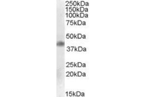 Image no. 1 for anti-Meis Homeobox 1 (MEIS1) (Internal Region) antibody (ABIN375073) (MEIS1 Antikörper  (Internal Region))