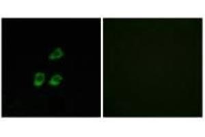 Immunofluorescence analysis of HUVEC cells, using CLCN4 antibody.