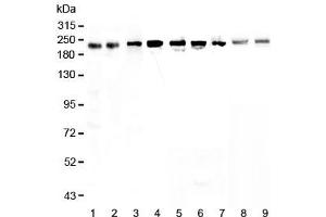Western blot testing of human 1) HeLa, 2) placenta, 3) MCF7, 4) A549, 5) A431, 6) SGC-7901, 7) 22RV1, 8) rat small intestine and 9) mouse small intestine lysate with BRG1 antibody at 0. (SMARCA4 Antikörper)