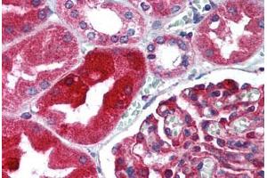 Human Kidney (formalin-fixed, paraffin-embedded) stained with TJP1 antibody ABIN305736 at 5 ug/ml followed by biotinylated goat anti-rabbit IgG secondary antibody ABIN481713, alkaline phosphatase-streptavidin and chromogen. (TJP1 Antikörper  (AA 463-1109))
