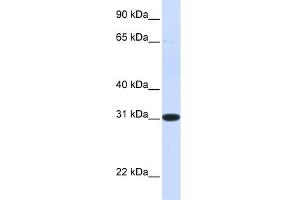 WB Suggested Anti-PBLD Antibody Titration: 0. (PBLD1 Antikörper  (N-Term))