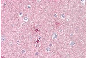 Anti-UBR5 antibody IHC staining of human brain, cortex. (UBR5 Antikörper  (AA 1-50))
