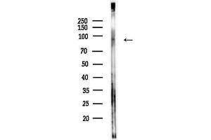 anti-Protein Phosphatase, Mg2+/Mn2+ Dependent, 1E (PPM1E) (Internal Region) antibody