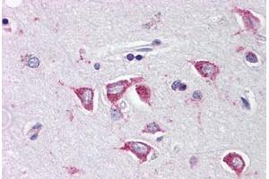 Human Brain, Cortex (formalin-fixed, paraffin-embedded) stained with PCBP4 antibody ABIN214462 at 2. (PCBP4 Antikörper  (C-Term))