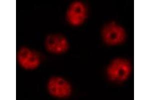 Immunofluorescence (fixed cells) (IF/ICC) image for anti-DNA-Damage-Inducible Transcript 3 (DDIT3) (N-Term) antibody (ABIN6260816)