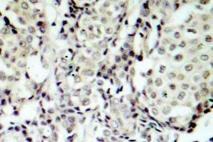 Image no. 1 for anti-Mitogen-Activated Protein Kinase Kinase 3 (MAP2K3) antibody (ABIN265520) (MAP2K3 Antikörper)