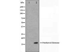 Western blot analysis on A549 cell lysate using Parathyroid Hormone Antibody. (PTH Antikörper  (Internal Region))