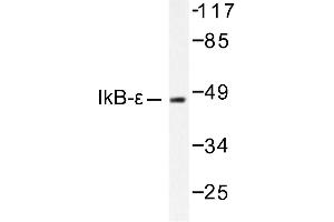 Image no. 1 for anti-Nuclear Factor of kappa Light Polypeptide Gene Enhancer in B-Cells Inhibitor, epsilon (NFKBIE) antibody (ABIN265484) (NFKBIE Antikörper)