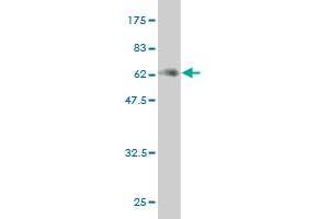 Western Blot detection against Immunogen (59. (MEOX2 Antikörper  (AA 1-303))