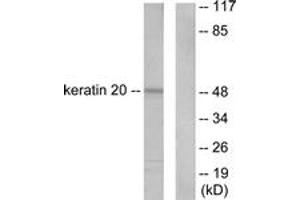 Western blot analysis of extracts from HeLa cells, using Keratin 20 Antibody. (KRT20 Antikörper  (AA 375-424))