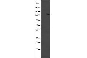 Western blot analysis of GRIP1 expression in fetal muscle lysate ,The lane on the left is treated with the antigen-specific peptide. (GRIP1 Antikörper  (Internal Region))