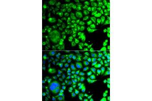 Immunofluorescence analysis of A549 cells using TBPL1 antibody (ABIN5975608). (TBPL1 Antikörper)