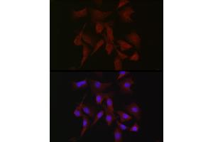 Immunofluorescence analysis of NIH-3T3 cells using PRKCB Rabbit pAb (ABIN6128462, ABIN6146199, ABIN6146201 and ABIN6217699) at dilution of 1:50 (40x lens). (PKC beta Antikörper  (AA 1-270))