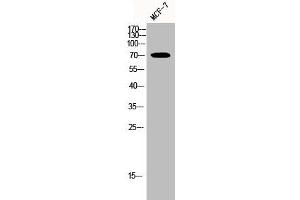 Western Blot analysis of MCF-7 cells using HSP70 Polyclonal Antibody (HSPA1L Antikörper  (Internal Region))