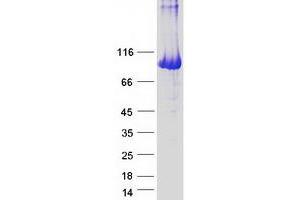 Western Blotting (WB) image for phosphorylase, Glycogen, Liver (PYGL) protein (Myc-DYKDDDDK Tag) (ABIN2722040)
