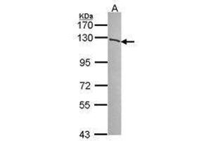 Image no. 1 for anti-Poly (ADP-Ribose) Polymerase 1 (PARP1) (AA 84-247) antibody (ABIN467447)