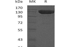 Western Blotting (WB) image for Tumor Necrosis Factor Receptor Superfamily, Member 21 (TNFRSF21) protein (His tag) (ABIN7320730)