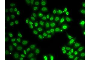 Immunofluorescence analysis of HeLa cells using EWSR1 antibody (ABIN5970844). (EWSR1 Antikörper)