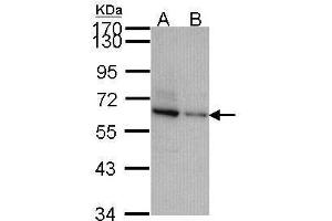 WB Image Sample (30 ug of whole cell lysate) A: JurKat B: NT2D1 7. (TOM1L2 Antikörper  (C-Term))