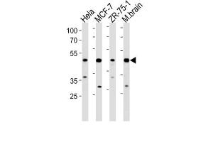 Western Blotting (WB) image for anti-F-Box Protein 28 (FBXO28) antibody (ABIN3004599)
