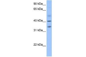ZC3H14 antibody used at 1 ug/ml to detect target protein.