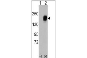 Western blot analysis of EGFR (arrow) using rabbit polyclonal EGFR Antibody i. (EGFR Antikörper  (AA 956-985))