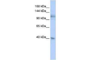 MSH2 antibody used at 1 ug/ml to detect target protein. (MSH2 Antikörper)