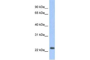 Western Blotting (WB) image for anti-Mitochondrially Encoded NADH Dehydrogenase 6 (MT-ND6) antibody (ABIN2459383)
