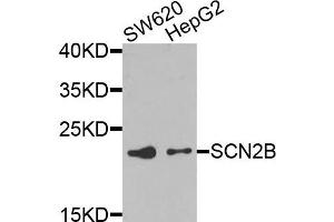 Western blot analysis of extracts of SW620 and HepG2 cells, using SCN2B antibody.