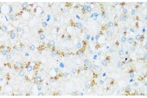 Immunohistochemistry of paraffin-embedded Human liver using APOD Polyclonal Antibody at dilution of 1:100 (40x lens). (Apolipoprotein D Antikörper)
