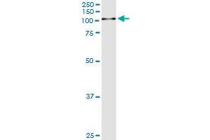 Western Blotting (WB) image for anti-Gelsolin (GSN) (AA 673-782) antibody (ABIN561153)