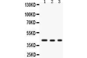 Western Blotting (WB) image for anti-Growth Associated Protein 43 (GAP43) (AA 216-238), (C-Term) antibody (ABIN3043685) (GAP43 Antikörper  (C-Term))